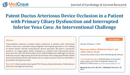 Memopart™ PDA Occluder Successfully Rescued Children With Complex Congenital Heart In Pakistan