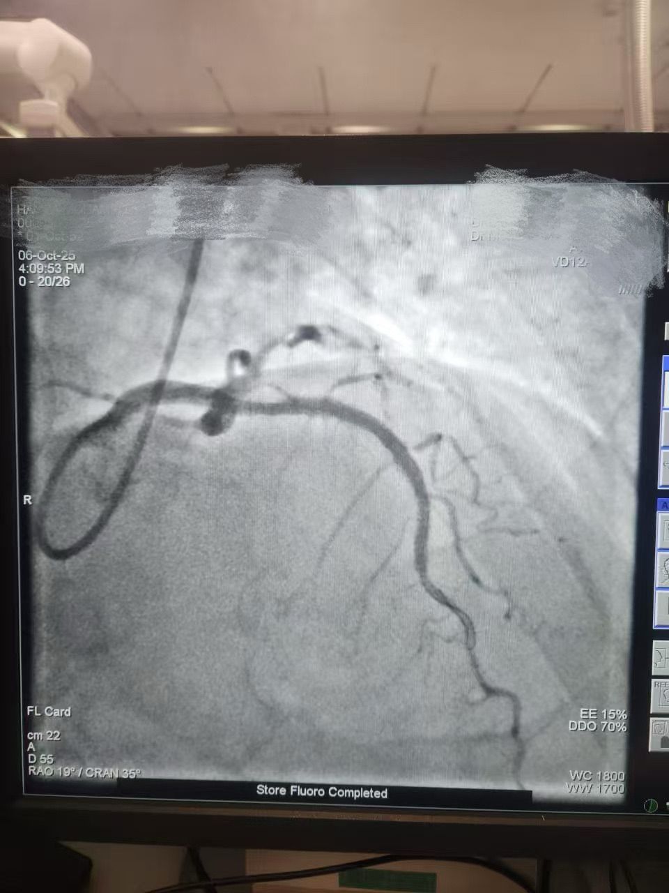 1762398144350956.jpeg 1762398144350956.jpeg