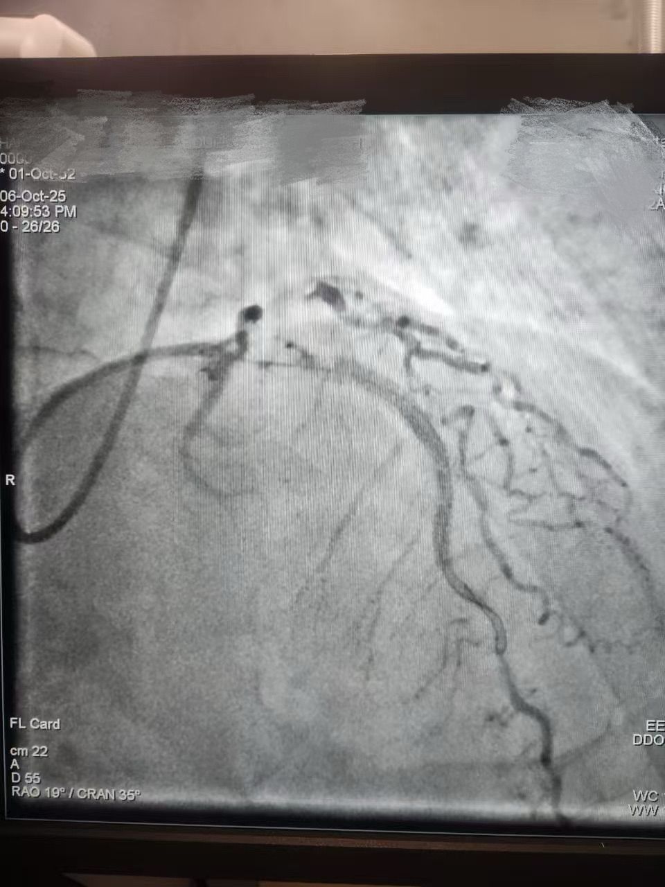 1762398146782181.jpeg 1762398146782181.jpeg