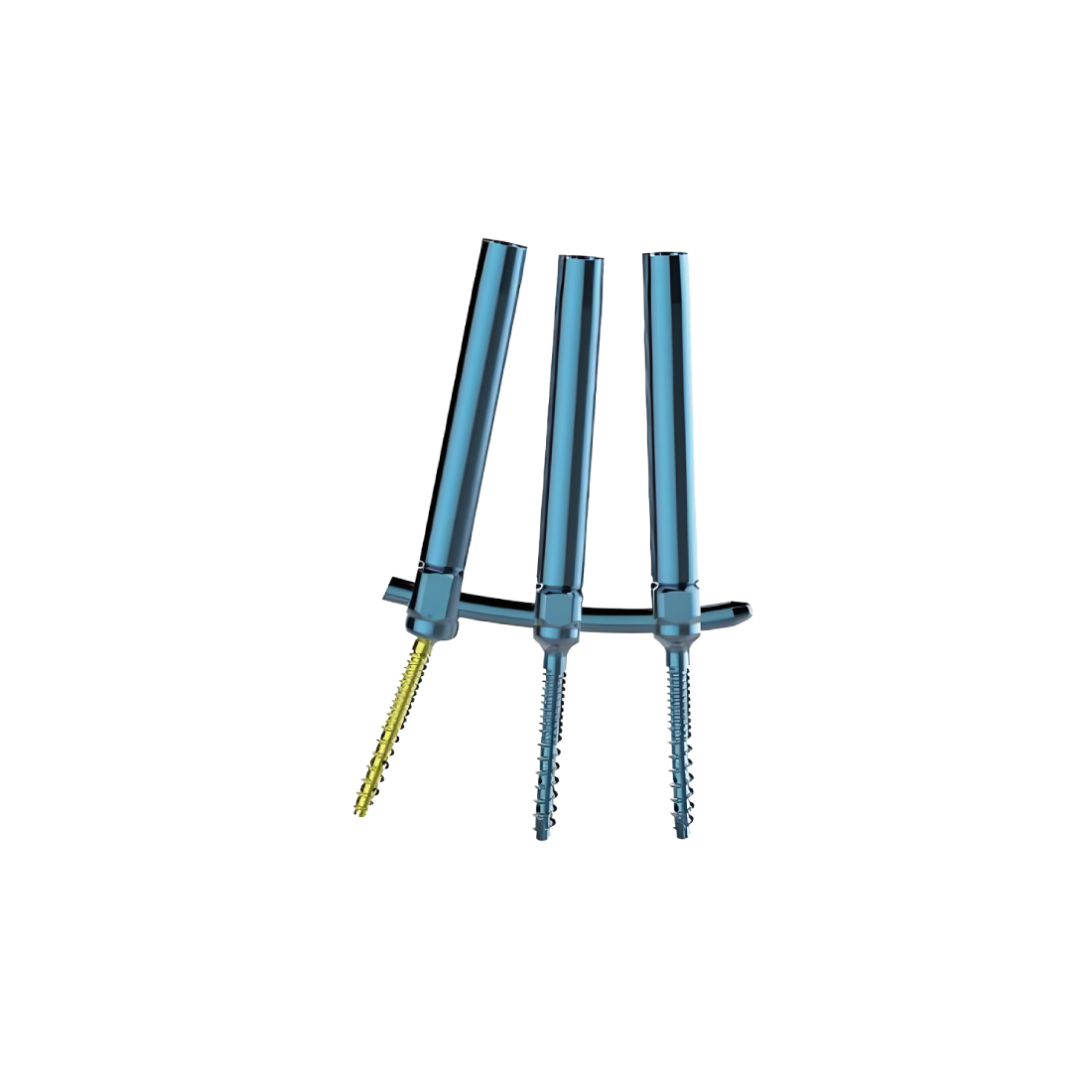 Internal Spinal Fixation System