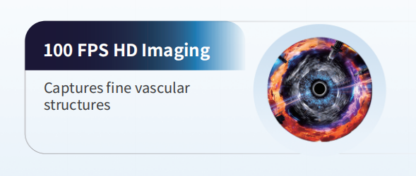 100 FPS HD Imaging