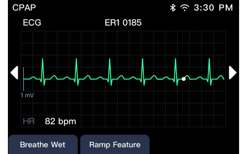 ord datatypefor datafanyifanyiSetting ECG