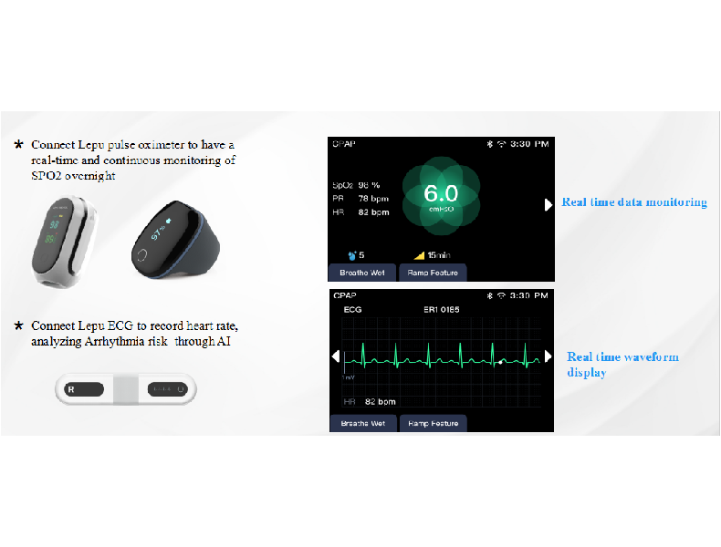atypefor datafanyifanyiAdvantage Supports Bluetooth wearable devices, reduces cable constraints Supp...