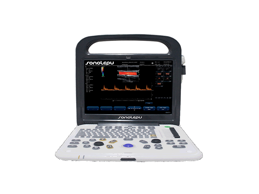 Portable Ultrasound