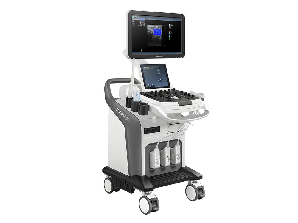 Trolley Ultrasound