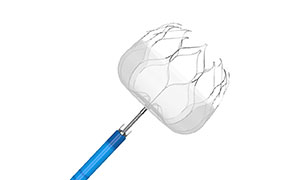 Application and Classification of Left Atrial Appendage Occluder