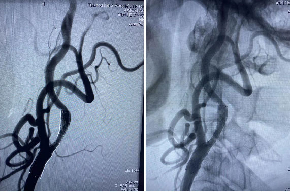 Postoperative-imaging.jpg