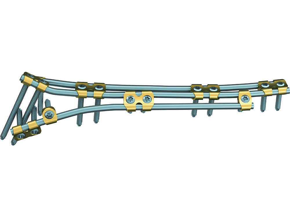 Orthopedic Products