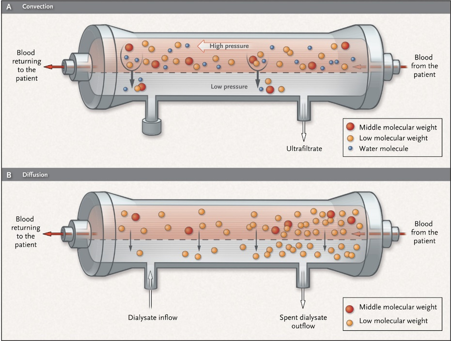 Hemodialysis Vs Hemofiltration - Lepu Medical Technology(Beijing)Co.,Ltd.